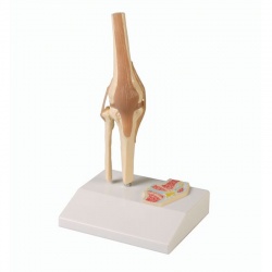 Miniature Knee Joint with Cross-Section